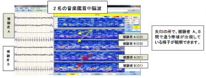 音楽鑑賞中脳波